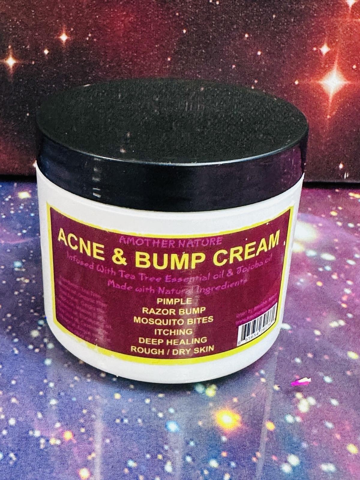 AMother Nature Acne & Bump Cream
